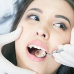 Cuidados básicos para tus prótesis dentales