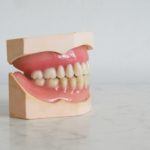 Todo sobre las prótesis dentales flexibles Valplast