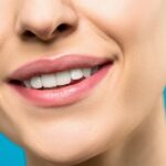 Dudas frecuentes sobre el blanqueamiento dental
