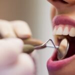 ¿Por qué es tan necesaria la limpieza dental?